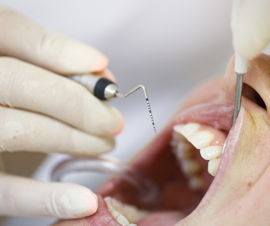 علاج أمراض النسج الداعمة المتقدم