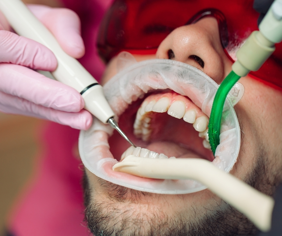 تنظيف احترافي وتلميع